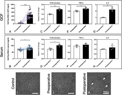 The potential role of cfDNA-related innate immune responses in postoperative bone loss after alveolar bone grafting